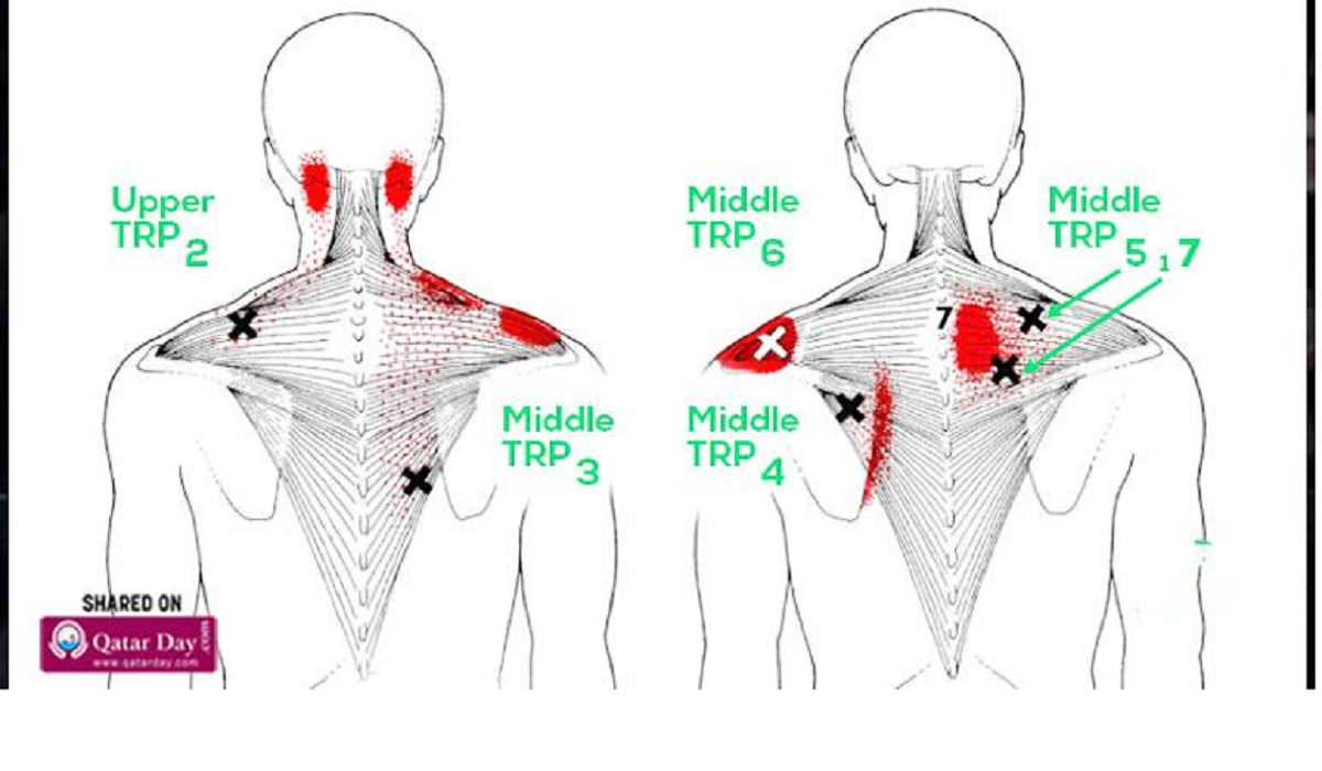 Try These 15 Stretches to Relieve a Stiff Neck and Tight Shoulders and Upper Back Pain